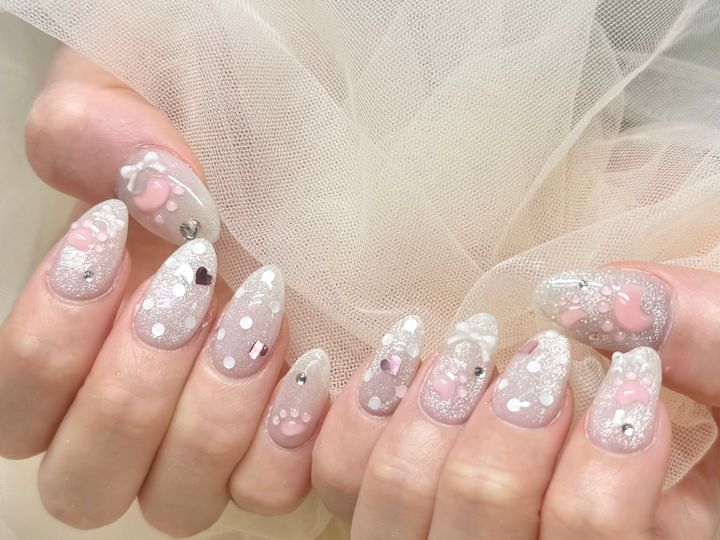 グリーンネイルとは何か｜夏に急増するトラブルの正体のイメージ