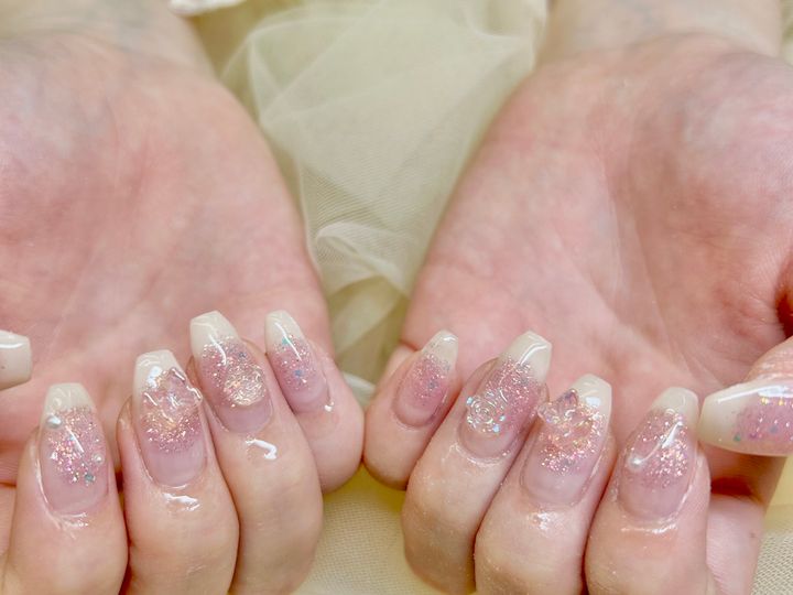 夏こそフィルイン（一層残し）が正解な理由のイメージ