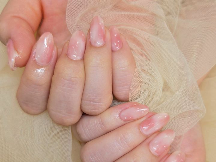 パラジェルとフィルイン、育爪手段としての違いと選び方のイメージ